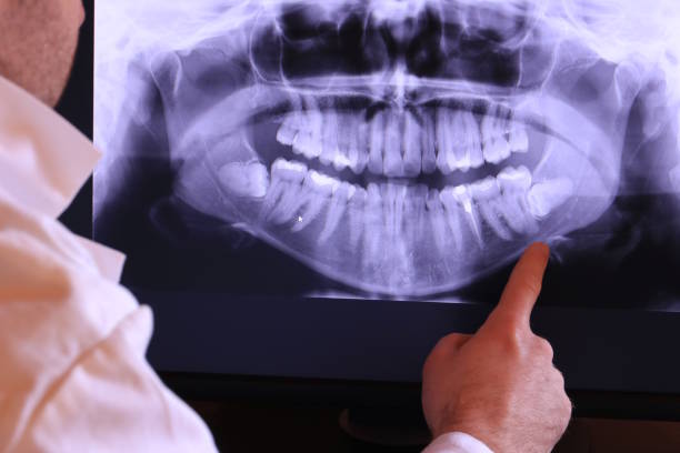 Best Tooth Infection Emergency Dentist  in Fostoria, OH
