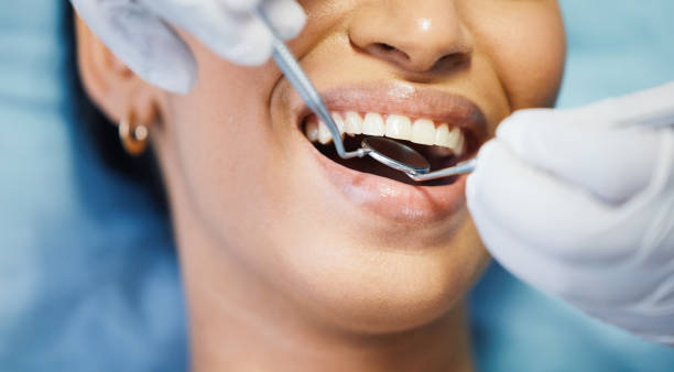 Best Cracked Tooth Emergency Dentist  in Fostoria, OH