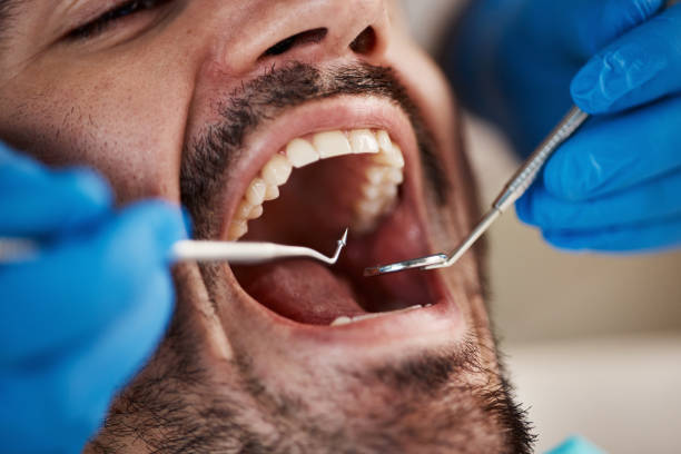 Best Root Canal Emergency Dentist  in Fostoria, OH