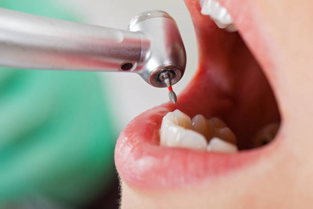 Emergency Dentist for Kids in OH